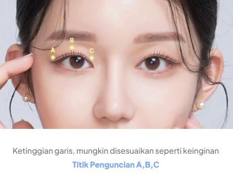 browlift4